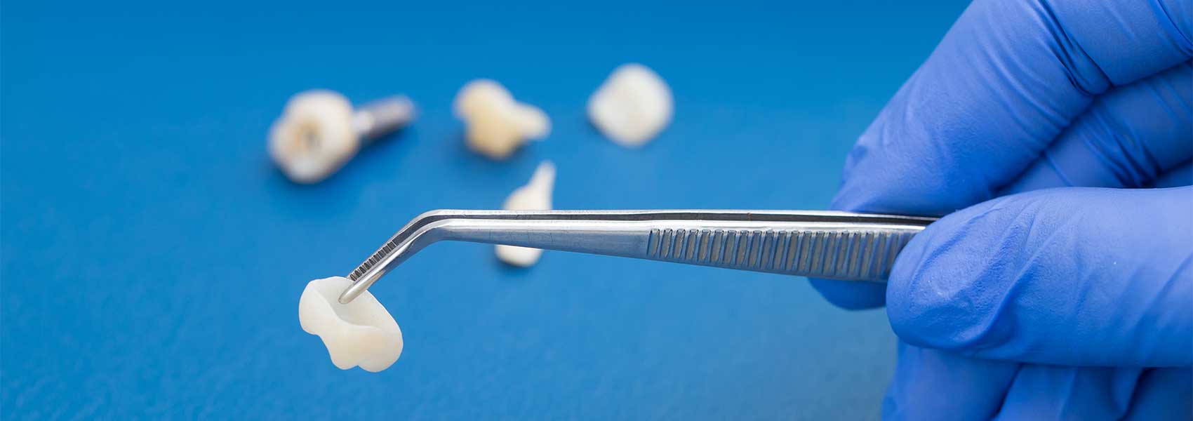 A dentist is holding tweezers for dental crown